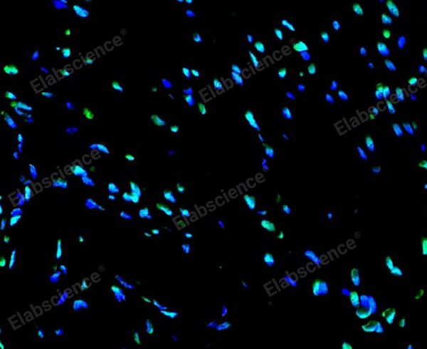 One-step TUNEL In Situ Apoptosis Kit (Green, FITC)